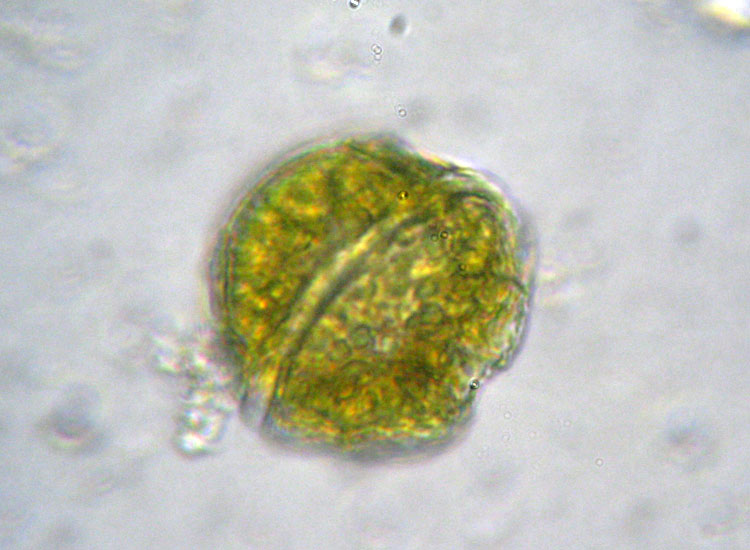 Dinoflagellati